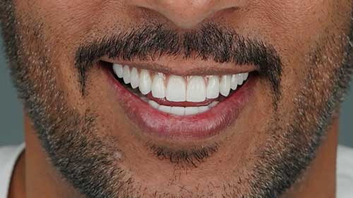 Debunking Dental Myths: Fact Vs. Fiction